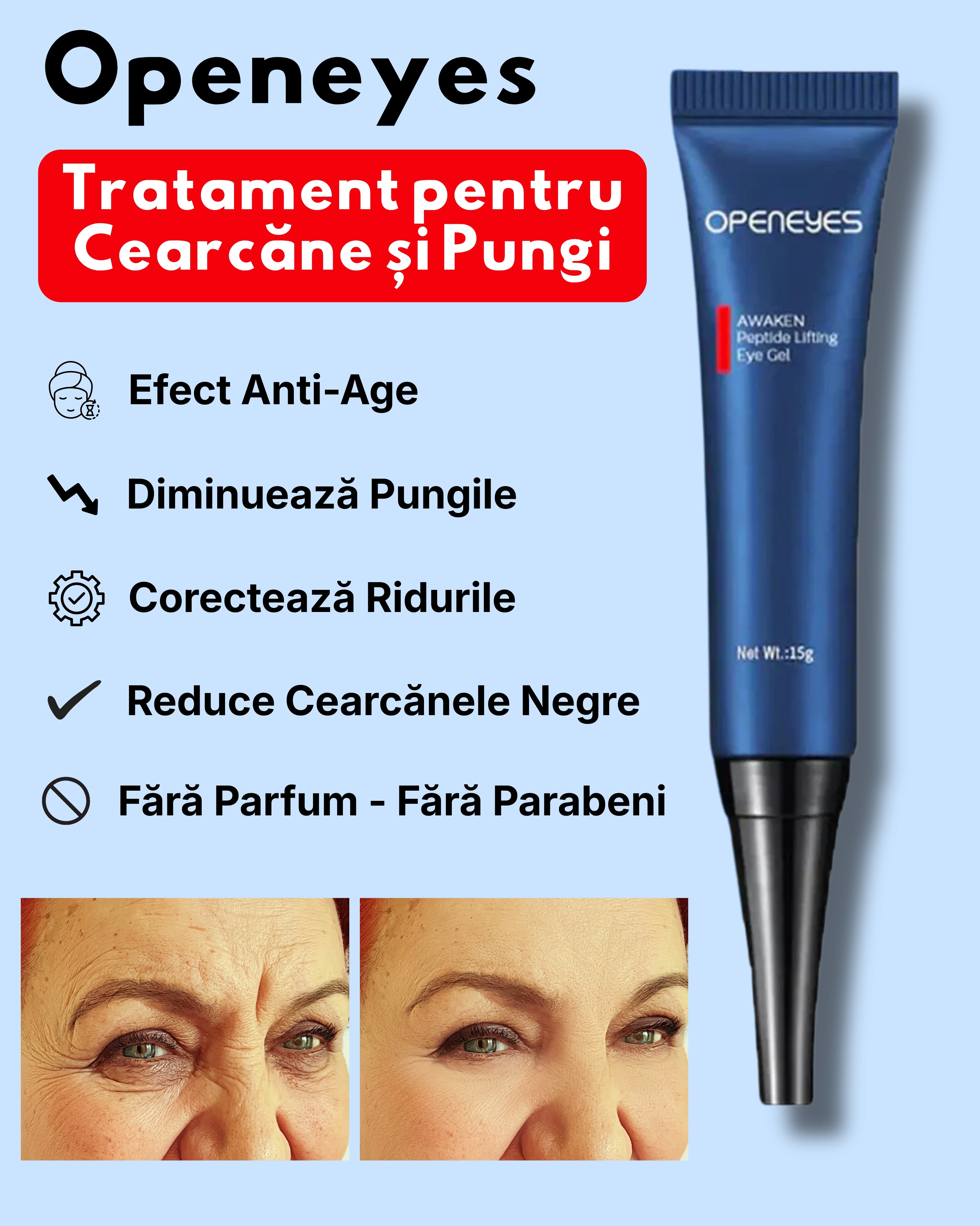 Openeyes - Super Gel pentru Cearcăne – Alos.ro