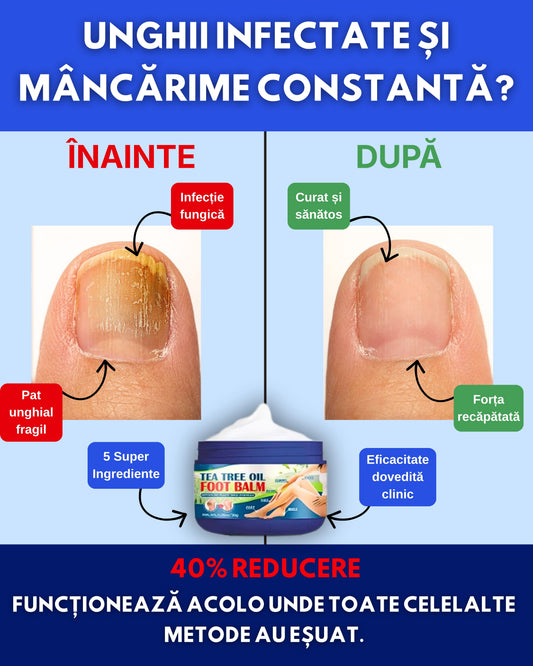 Crema pentru ciuperca piciorului