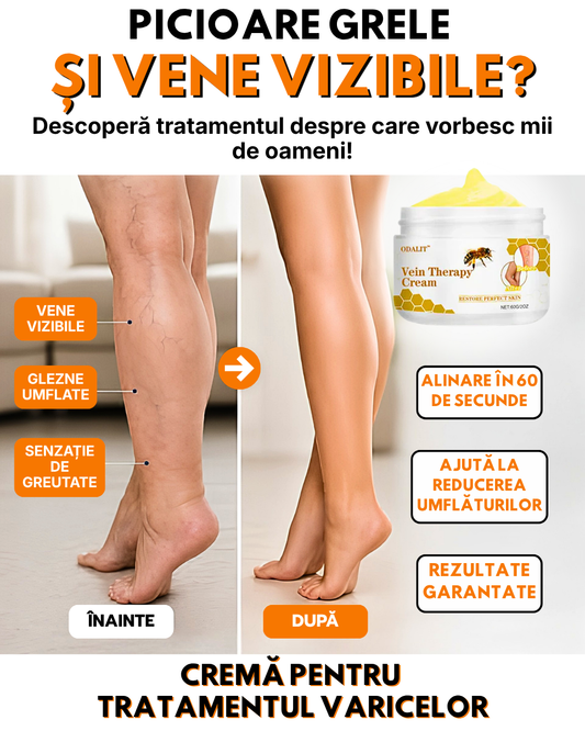 Cremă pentru tratamentul varicelor