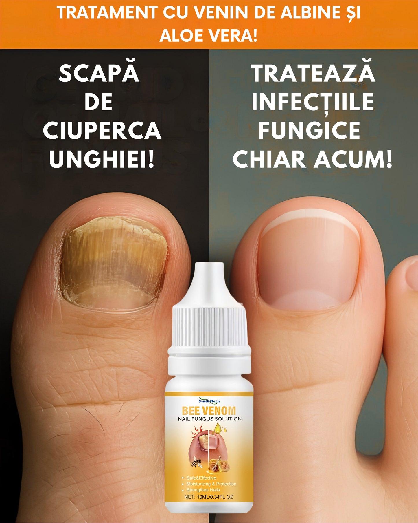 Solutie cu Venin de albine pentru ciuperca unghiei